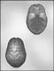 3-D Brain Chocolate Candy Mold